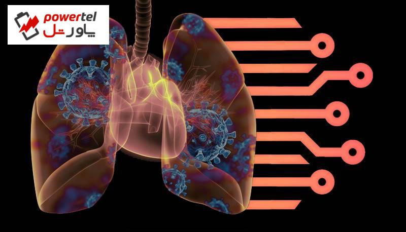 تشخیص دقیق آلودگی کرونایی در ریه به کمک هوش مصنوعی